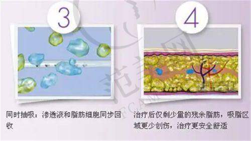 石家庄芘丽芙贵美人美容医院地址及乘车路线
