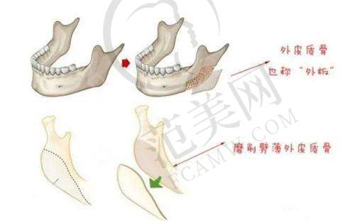 广州曙光和美莱哪个好？价格对比一目了然