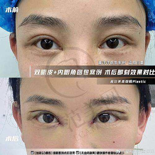 吴承道医生口碑和评价