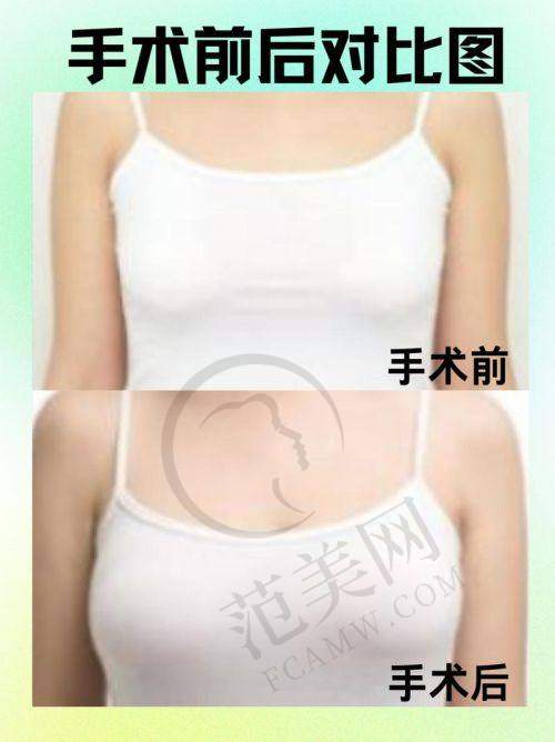 苏州芘丽芙华美医院口碑好不好：真实患者评价见证实力