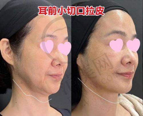 成都刘远程医生口碑怎么样？综合口碑获认可