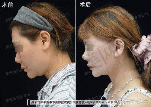 成都刘远程医生口碑怎么样？口碑背后是实力支撑