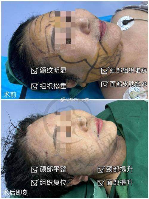 成都刘远程医生口碑怎么样？服务态度贴心