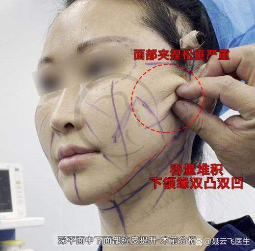 成都刘远程医生口碑怎么样？患者评价良好