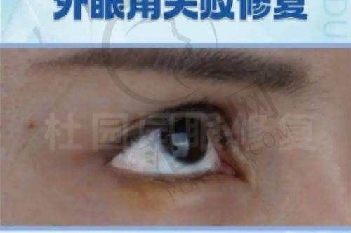 新兴医美机构在2025新版成都十大整形医院排名榜中有哪些亮点？
