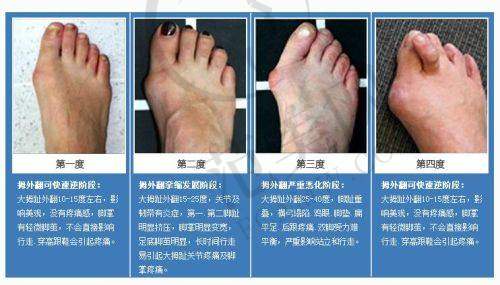 保定华美整形美容医院擅长哪些项目？