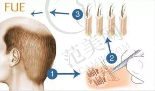 苏州奥拉克整形医院医生简介