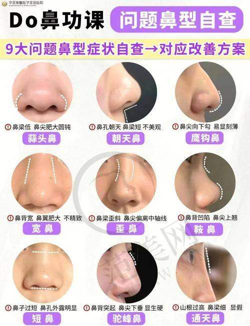 康春雨深圳米兰柏羽医学美容医院脂肪移植、面部整形手术、隆胸手术、吸脂减肥的号怎么挂