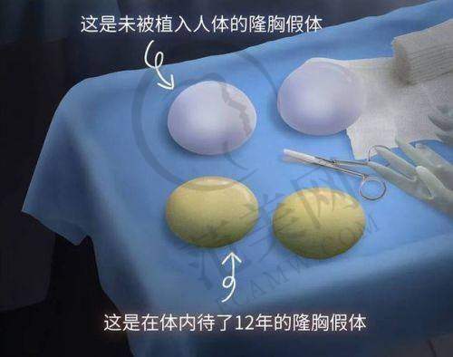 康春雨医生实例