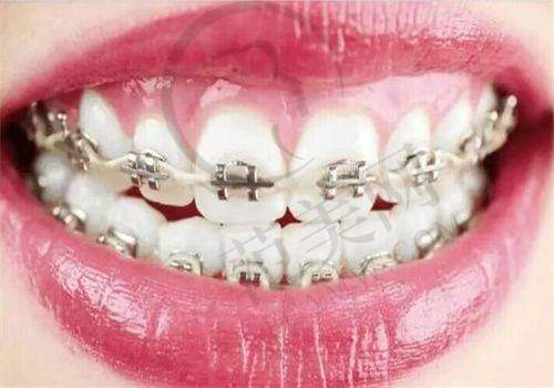 宁波做口腔十大医院2025榜单——宁波江北外滩好牙引领口腔