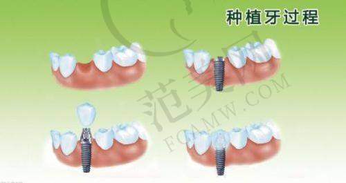 宁波十大口腔医院排名——宁波中瑞口腔医院