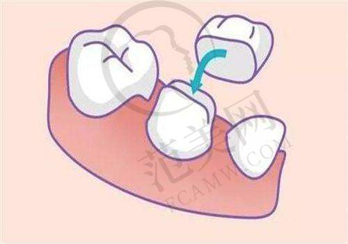 宁波更好的口腔医院排名——宁波鄞州牙壹家口腔