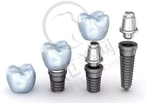 宁波做口腔十大医院2025榜单更新:曝光种植牙前十及牙齿贴面高性价比医院