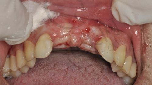 宁波十大口腔医院排名——宁波恒美口腔