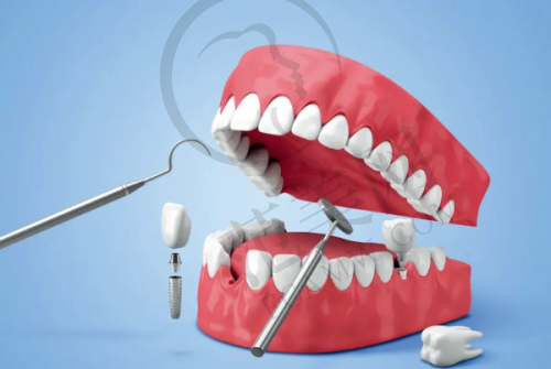 宁波更好的口腔医院排名——宁波中瑞口腔医院