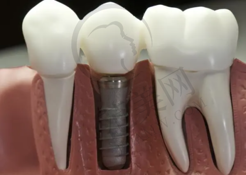 宁波十大口腔医院排名——宁波鄞州牙壹家口腔门诊部