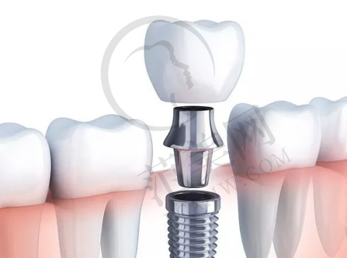宁波十大口腔医院排名——宁波美呀植牙口腔