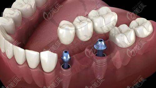 宁波十大口腔医院排名——宁波市第二医院口腔科