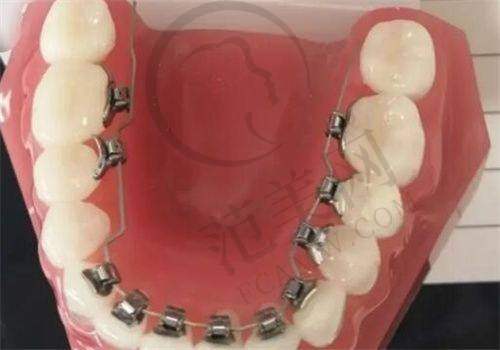 广州广大口腔何锦泉价格贵吗之总结与建议