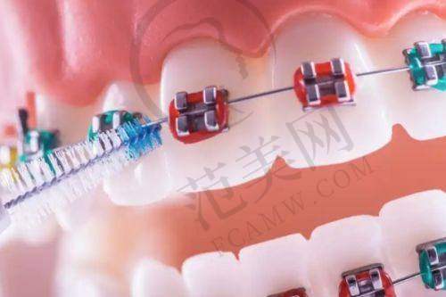 广州广大口腔何锦泉价格贵吗之价格对比