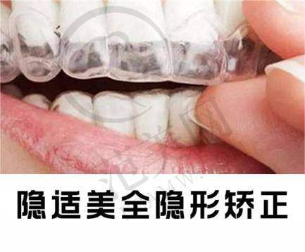 广州广大口腔肖盼盼手术价格与其他医院对比