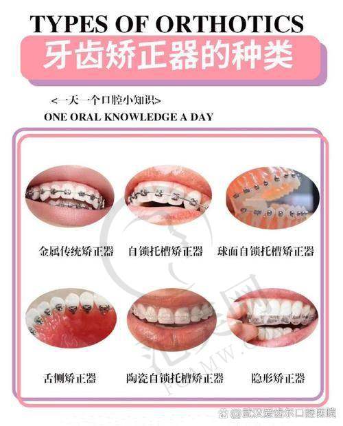 广州广大口腔肖盼盼手术价格之顾客好评