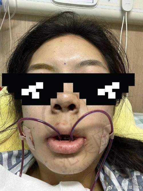 广州骨性龅牙医院价格对比之顾客好评