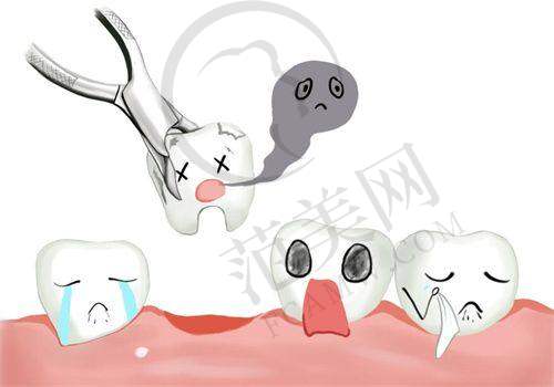 重庆做多生牙（双排牙）哪个医生好——重庆皇仕口腔门诊部
