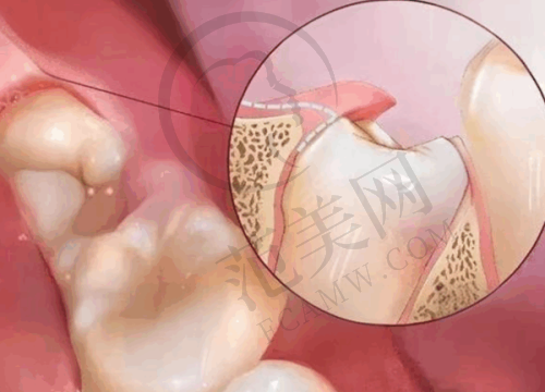 无锡下颌骨矫正医院价格对比详情