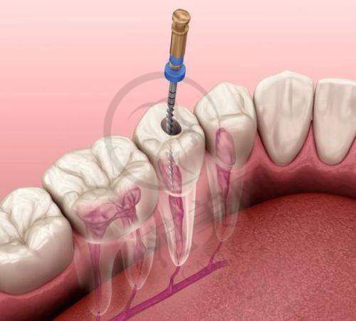 重庆儿童磨牙症哪家医院好——重庆市大坪医院