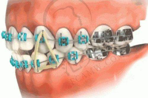 唐山儿童早期矫治医院价格表未来趋势