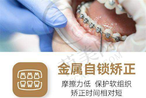 唐山儿童早期矫治医院价格表深度解析,4000元起亲民价与20000元以上高端方案对比