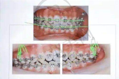 唐山儿童早期矫治医院价格表顾客好评