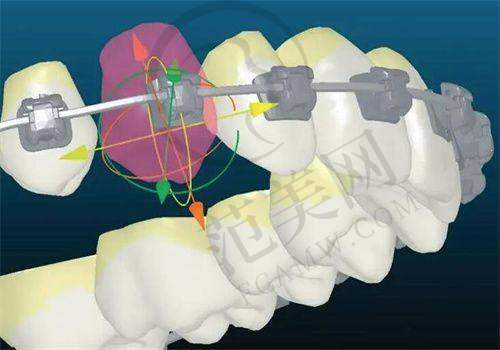 唐山口腔价格一览之基础治疗价格详情
