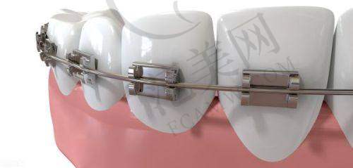 2025年重庆义齿医院排名——重庆牙卫士口腔