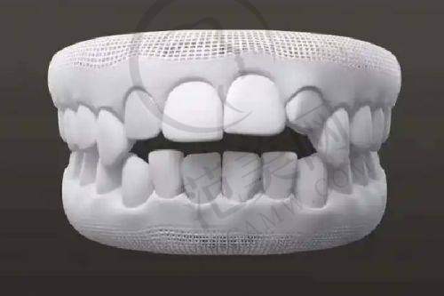 唐山儿童早期矫治医院价格表性价比分析