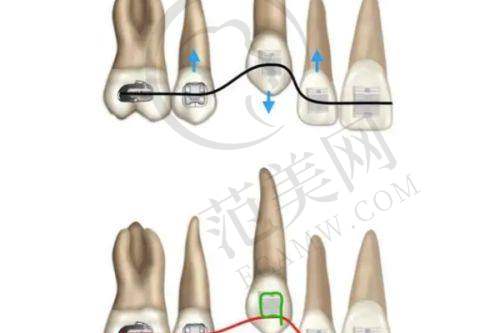 唐山深龋医院价格对比详情
