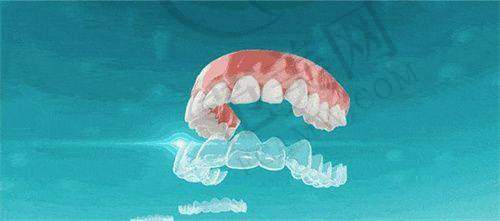 重庆哪家医院可以做牙齿整形——重庆团圆口腔医院