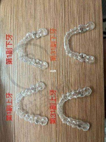 无锡下颌骨矫正医院价格对比影响因素