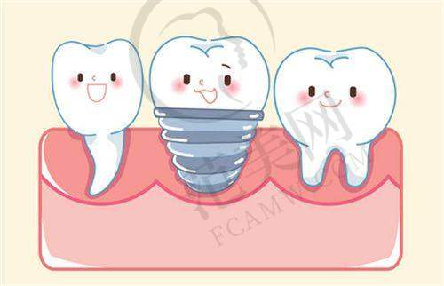 重庆贵金属烤瓷牙费用多少钱——重庆爱牙口腔医院