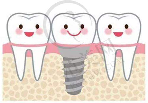 重庆附近哪家做瑞士士卓曼Straumann医院好——重庆牙博士口腔医院