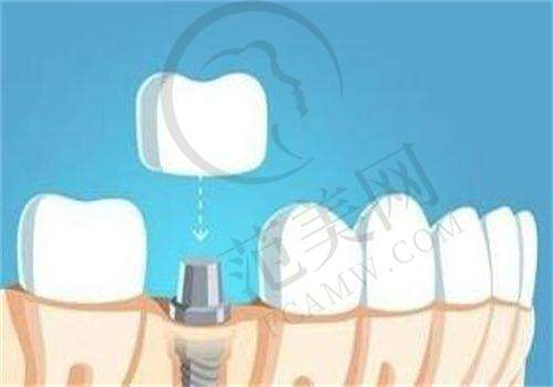 重庆哪家医院可以做牙齿整形?美奥/维乐/成佳牙博士等医院医生价格推荐