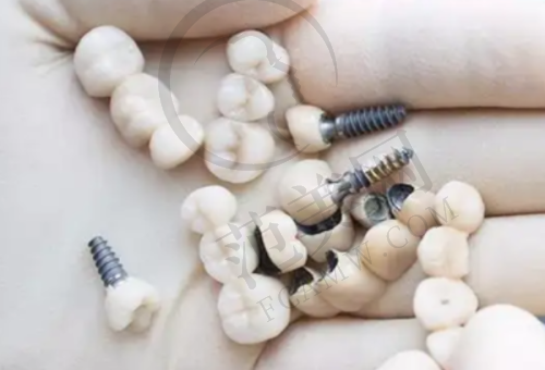 重庆德国AKLAS种植牙医院顾客好评