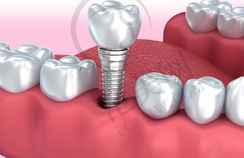 重庆铜梁王廷新口腔——擅长美格真种植牙手术的医院