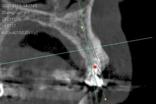 重庆上颌前突哪个好——重庆市中医院详情