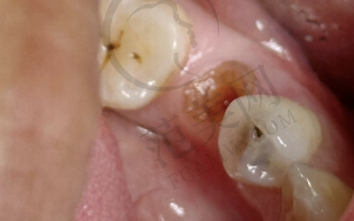 唐山口腔价格一览之顾客好评