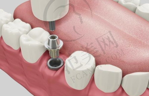 唐山口腔价格一览之价格影响因素分析