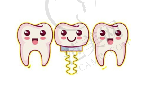 无锡德国费亚丹Frialit种植体价格对比分析