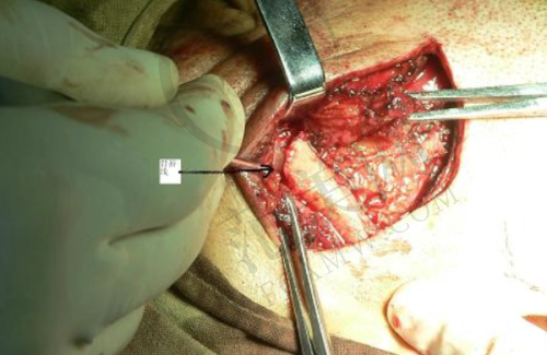 唐山深龋医院价格对比:低至 280 元与高至 9836 元背后的差异解析