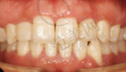 无锡下颌骨矫正医院价格对比周边可选择医院